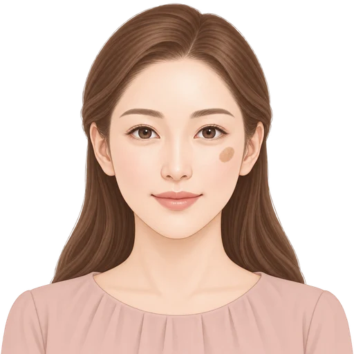頬に境界のある茶色い斑が見られる女性のイラスト