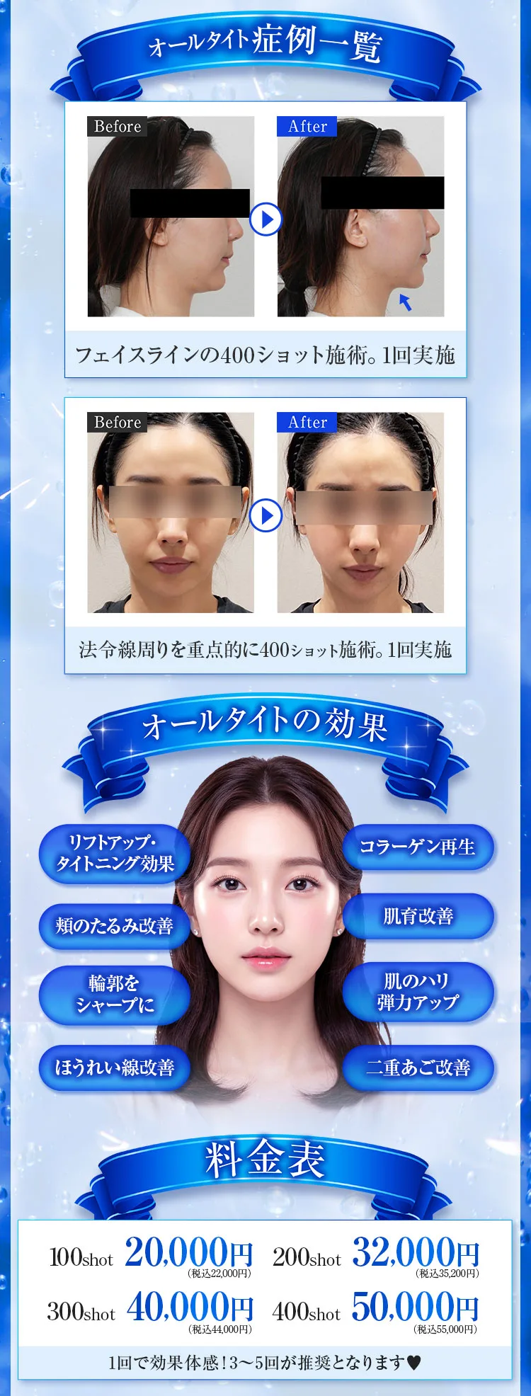 オールタイトの仕組みと施術のポイント